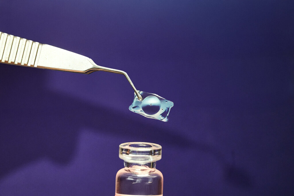 大學眼科公布 EVO ICL 膠原蛋白眼內鏡千眼數據，說明高度近視與高視覺需求族群的視力矯正趨勢